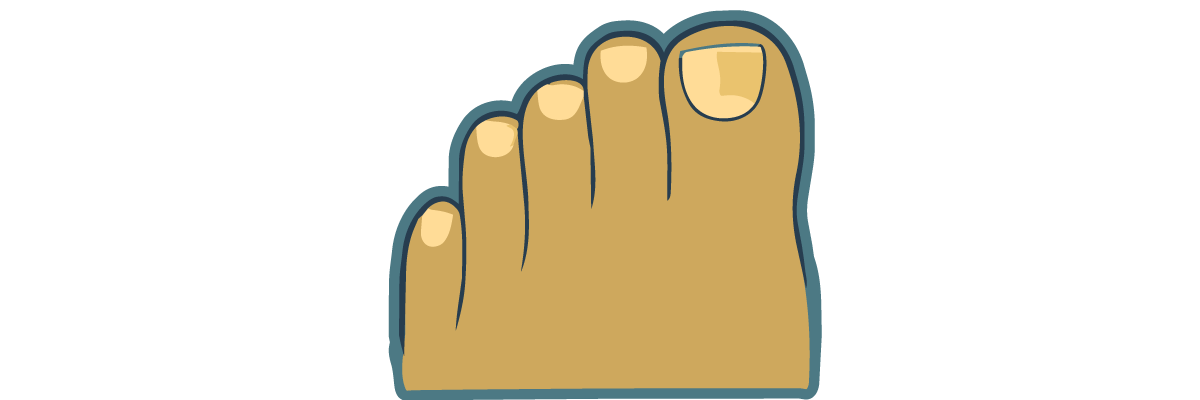 Onychomycosis and Other Nail Issues
